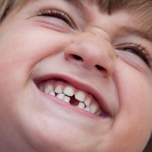 denti di bambino