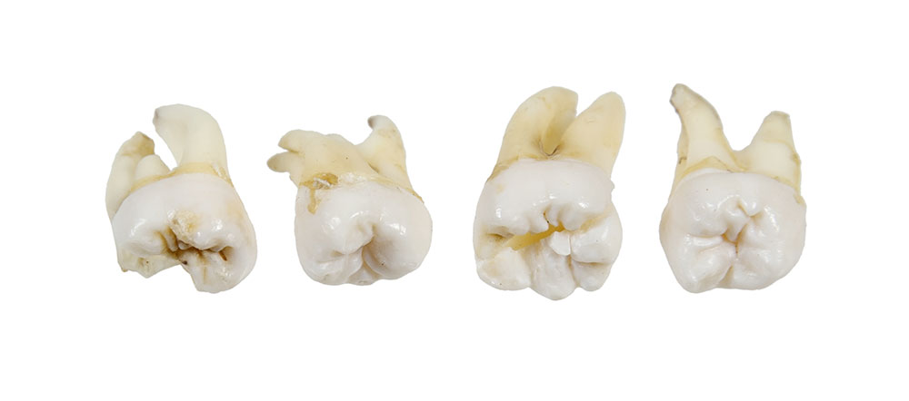 teeth health smile dentist baby