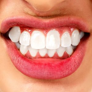 dentist TMJ teeth grinding 