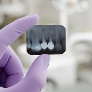 dental xray